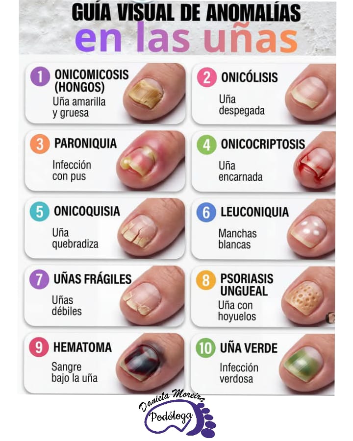 Guía visual de anomalías en las uñas